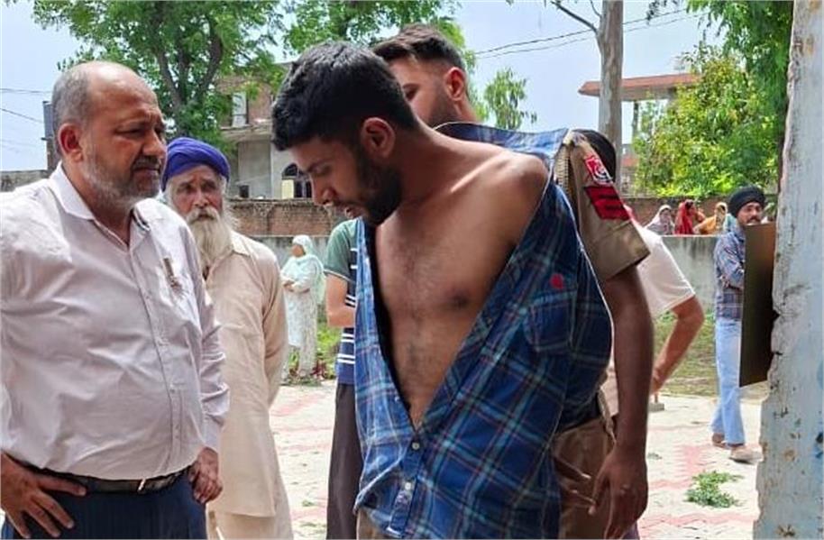 स्कूल में क्लास ले रही Teacher पर Acid Attack, अध्यापक सहित 2 बच्चे आए चपेट में