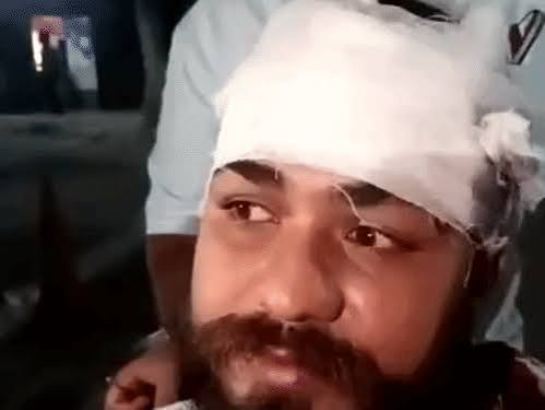 जालंधर में विवाद के बाद रेहड़ी संचालक पर हमला:आमलेट बनाने में देरी पर हुआ विवाद; सिर और बाजू पर गंभीर चोटें आई